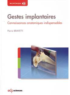 gestes-implantaires
