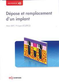 lfd83-depose-remplacement-implant