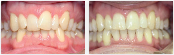 DentoSmile-Biotech-Dental