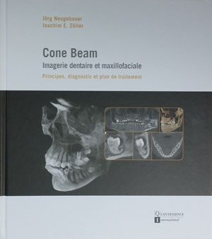 cone-beam-imagerie-dentaire-et-maxillofaciale