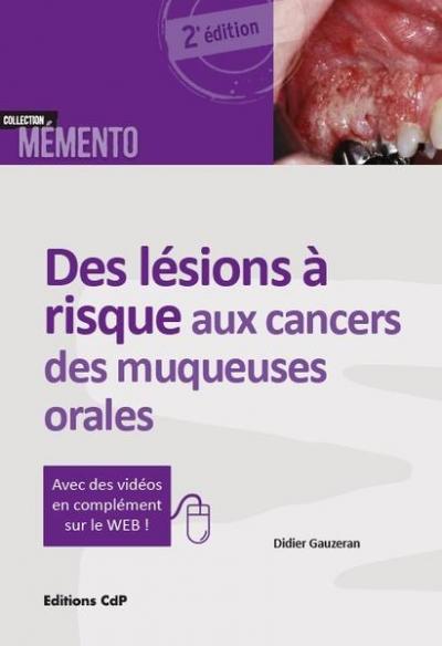 des-lesions-a-risque-aux-cancers-des-muqueuses-orales