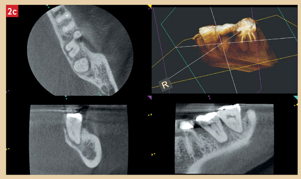 coupes-CBCT